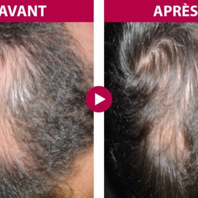 Guinot koncentratas vyrams